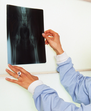 radiographie de la hanche sur un chien- dysplasie